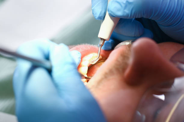 Best Tooth Infection Emergency Dentist  in Parker, AZ