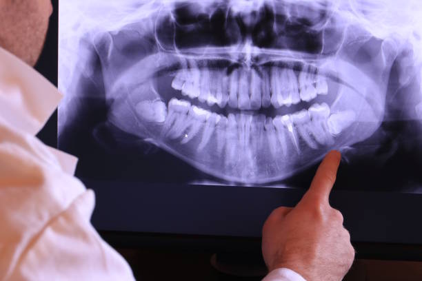Best Cracked Tooth Emergency Dentist  in Parker, AZ
