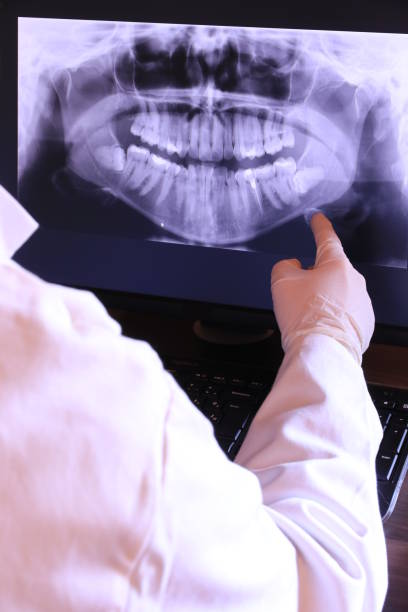Best Dentist for Tooth Abscess  in Parker, AZ